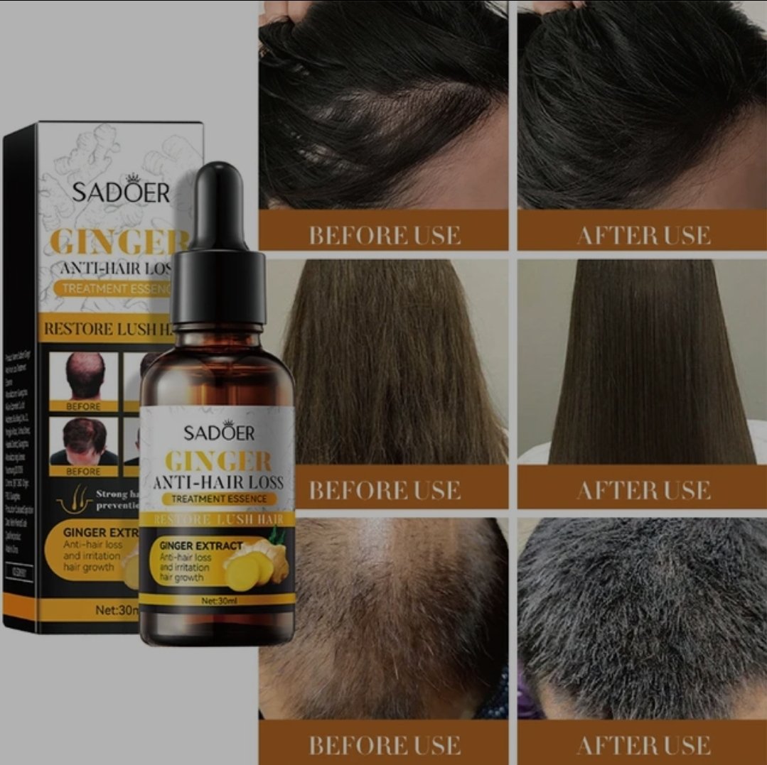 PAGUE 1 LLEVE 2 SERUM DE JENGIBRE PARA EL CABELLO