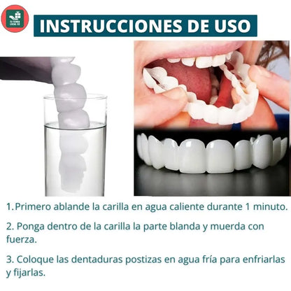 Carillas Dentales Snap On Smile