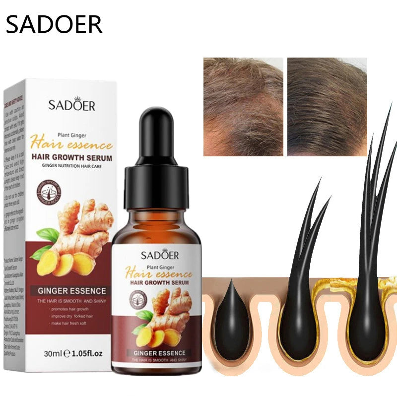 PAGUE 1 LLEVE 2 SERUM DE JENGIBRE PARA EL CABELLO