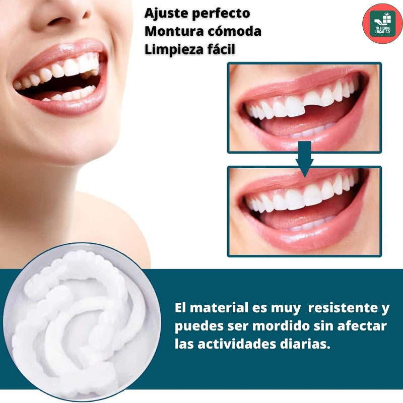 Carillas Dentales Snap On Smile